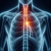 Esophageal/Esophagogastric Junction Cancers